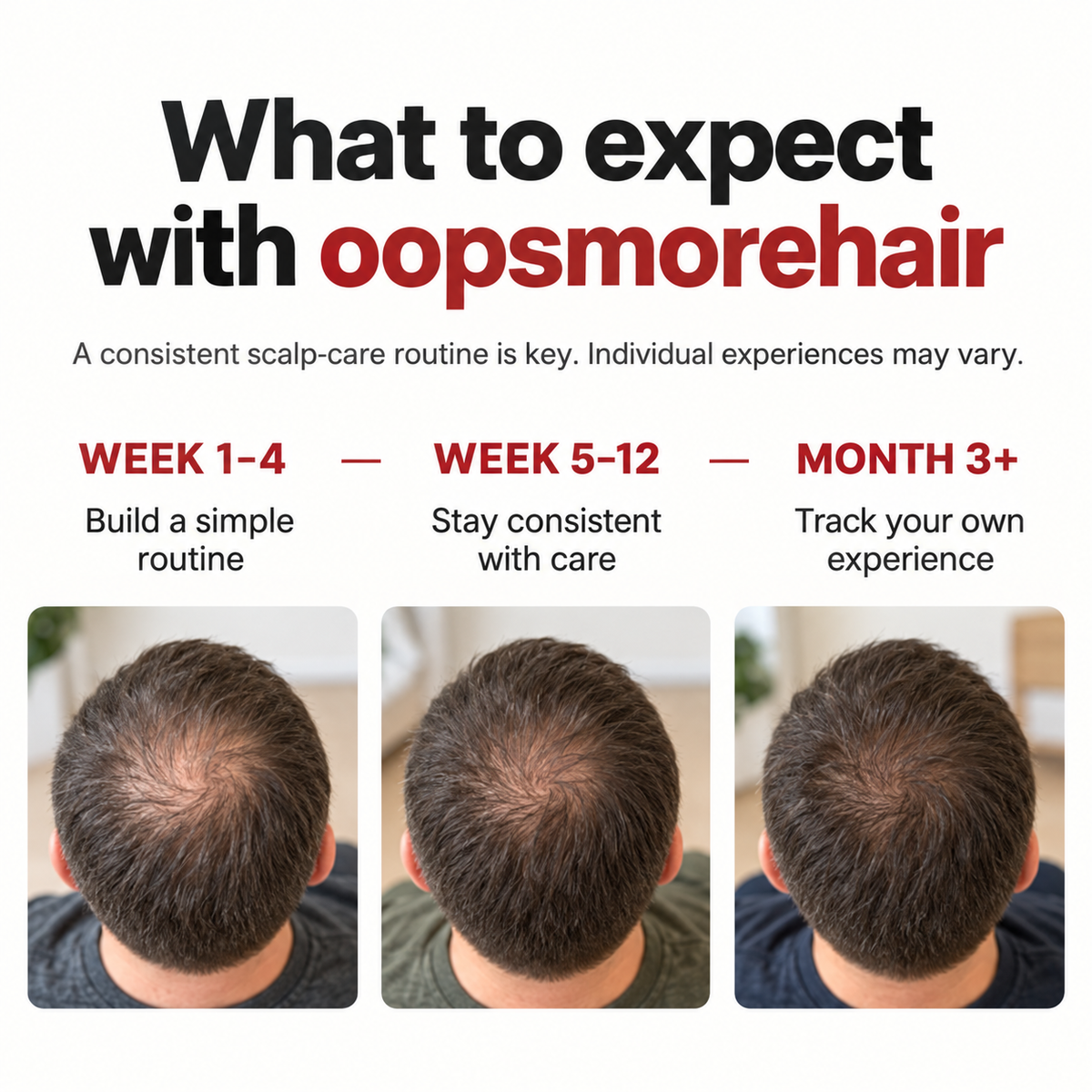 Regrow Thicker Hair in 16 Weeks — Hands-Free Laser Therapy That Fits Into Your Day