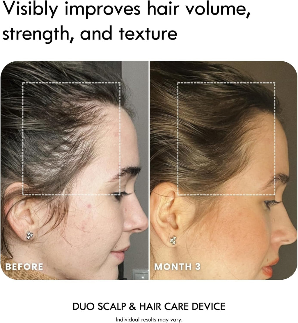 5-in-1 Scalp &amp; Hair Care Device thumbnail