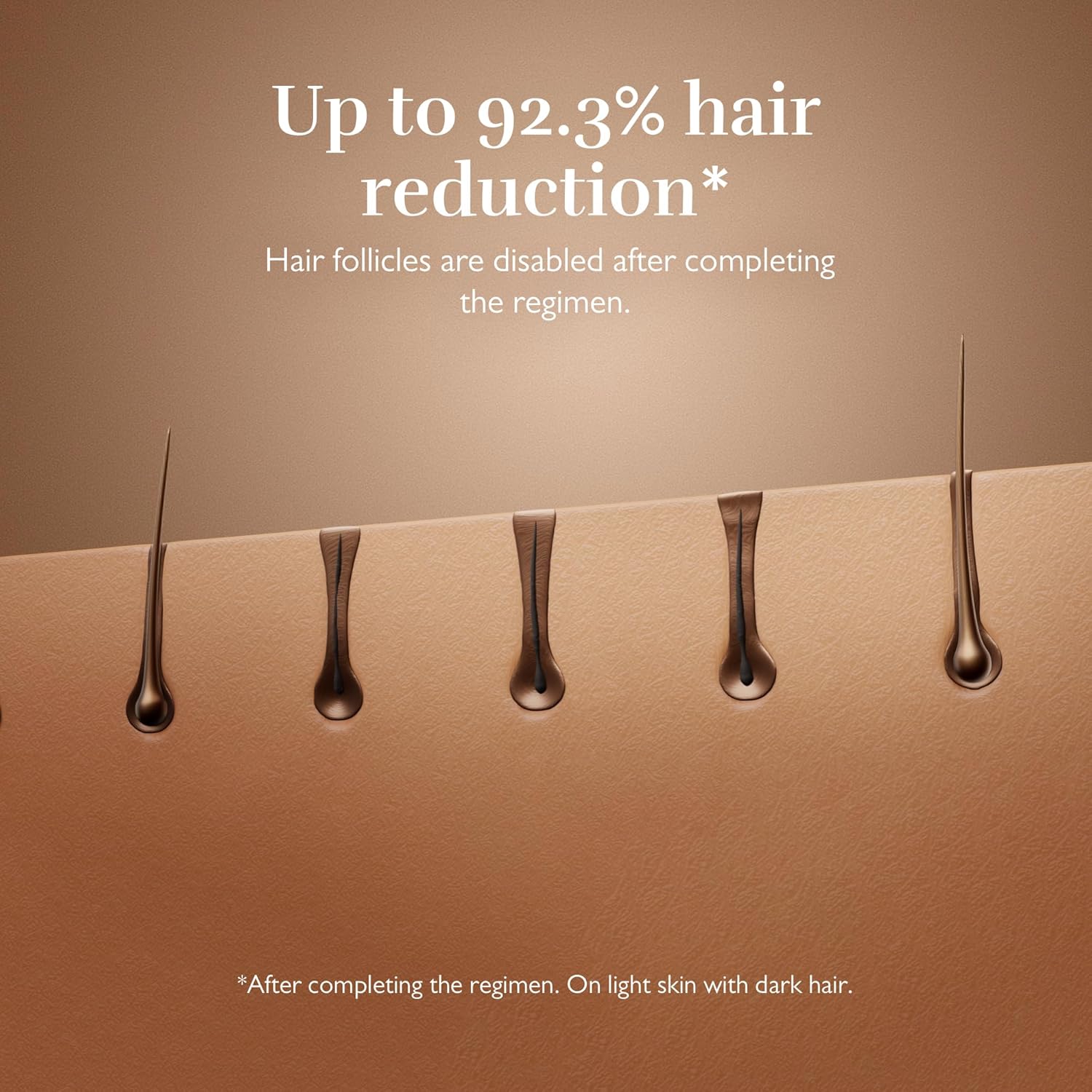 Hair Removal Device for Women and Men