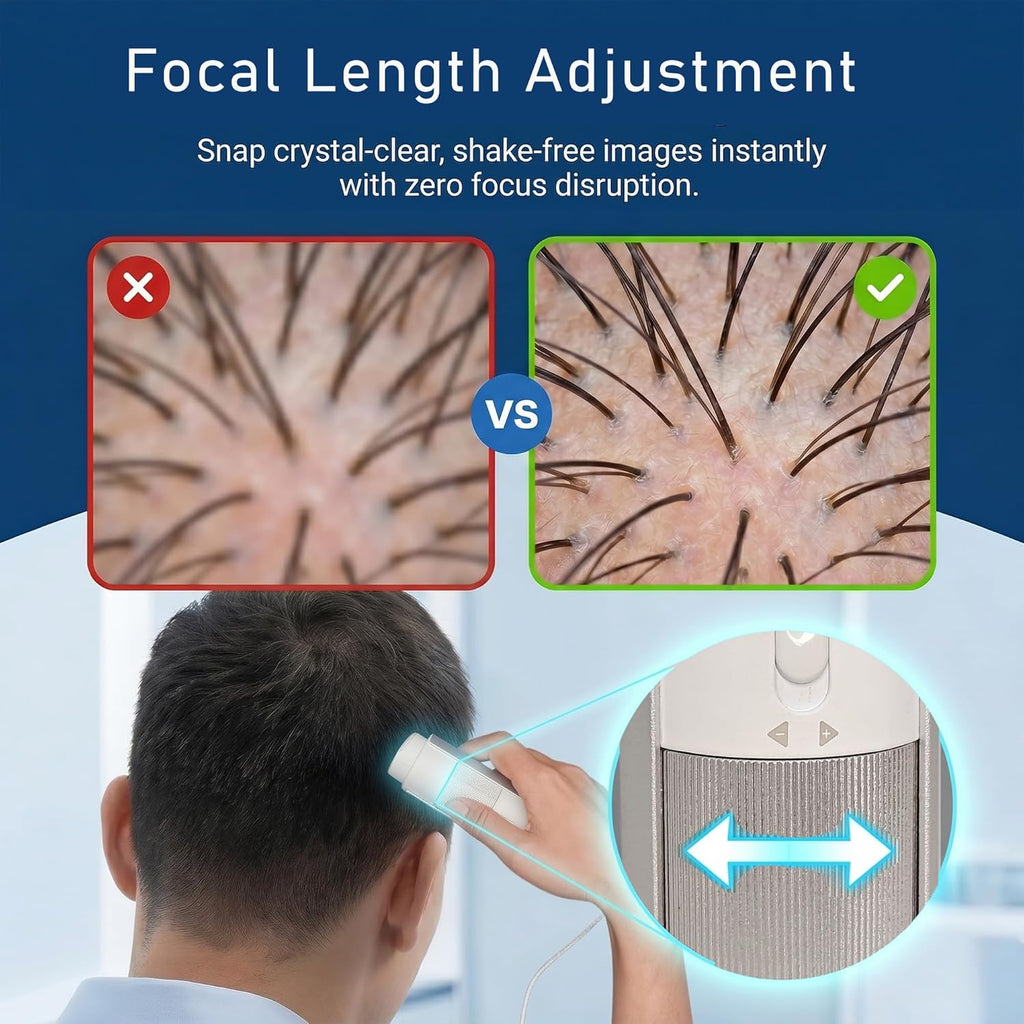 Scalp Analyzer Machine thumbnail